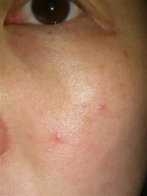 Knowing the main cause of pain on the skin can help the doctor to give you an accurate diagnosis. JL Journal: What do you use when your face ITCH and is ...