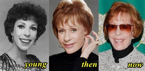 Carol Burnett Plastic Surgery Before And After