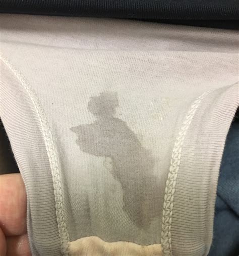 Normal Discharge On Underwear