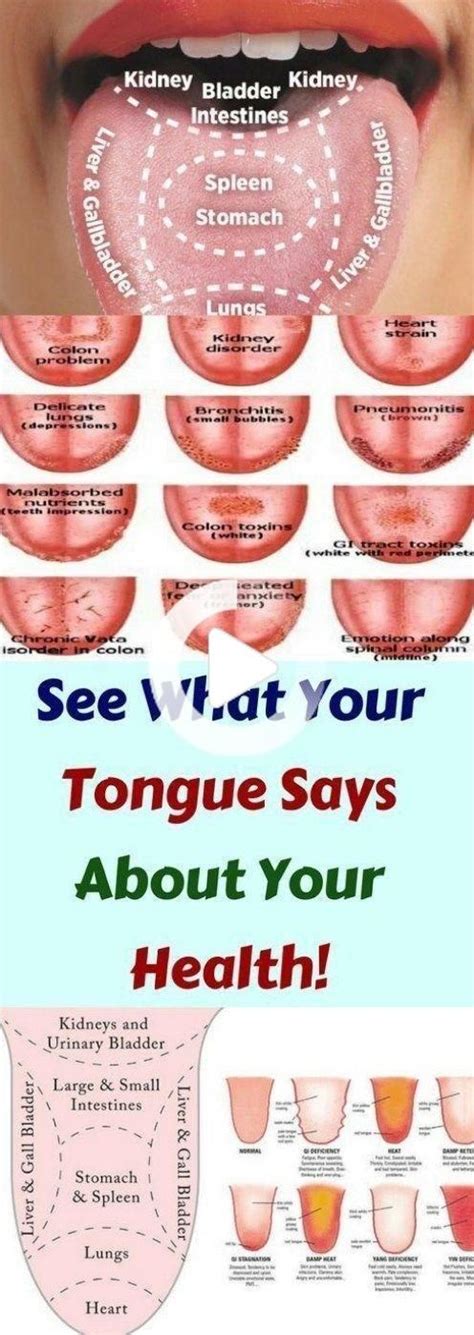 What Your Tongue Says About Your Health Tongue Health Health Natural Medicine