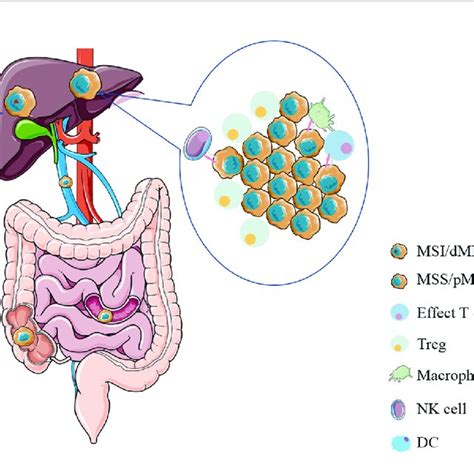 Summary Of Immunotherapy Approaches For Colorectal Cancer With Liver