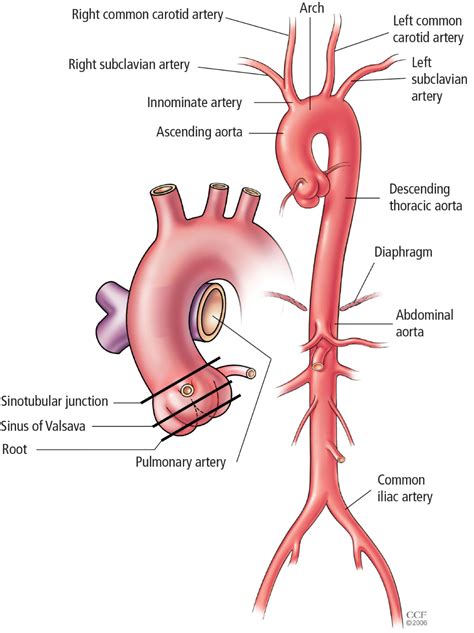 Aortic Replacement In Cardiac Surgery Medical Knowledge Pharmacology Nursing Medical Anatomy