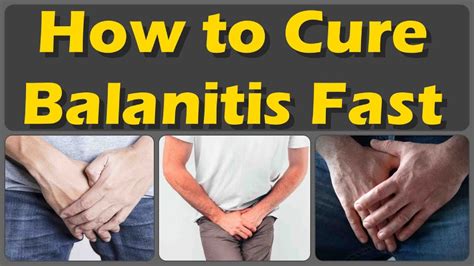 How To Cure Balanitis With Oils Fast And Causes Symptoms And Treatment Of Balanitis YouTube