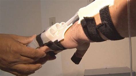 robotic hand helps stroke sufferers regain use of hands