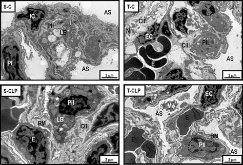 Electron Micrographs Of Lung Parenchyma Type Ii Cell Pii Type I
