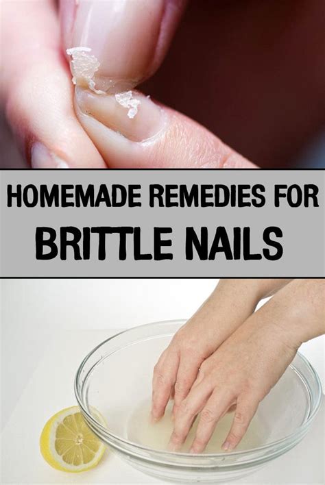 Homemade Remedies For Brittle Nails Iwomenhacks