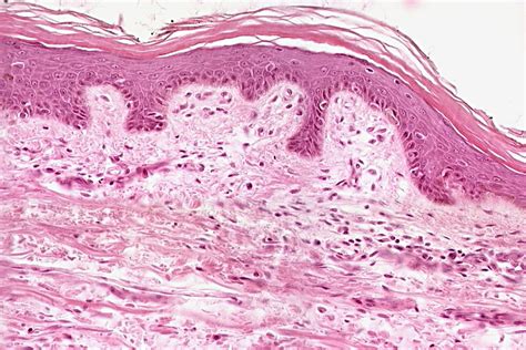 Find the perfect human skin stock photos and editorial news pictures from getty images. Histology Slides BIOL 150 Human Anatomy at Chaparral High School - StudyBlue