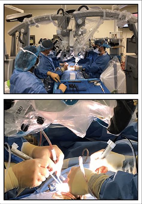 Intraoperative Setup With 2 Surgeons Working Simultaneously With 2