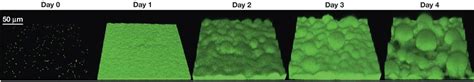 Solved In The Image Below What Stage Of Biofilm Formation Chegg Com