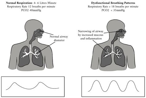 Jcm Free Full Text Breathing Re Education And Phenotypes Of Sleep