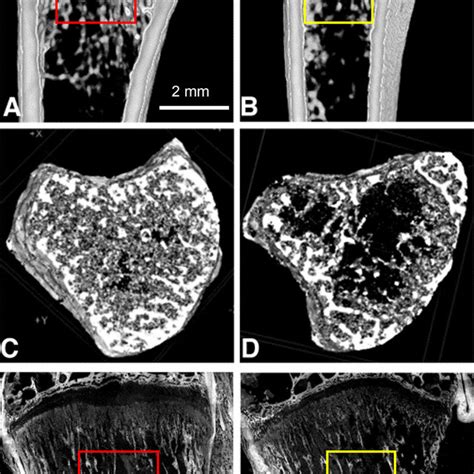 Demineralization In Trabecular Bone In 4 Week Old Diabetic Rat Tibia