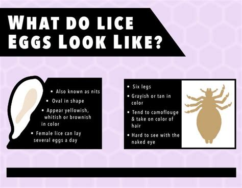 Check spelling or type a new query. 6 natural remedies to get rid of HEAD LICE EGGS - FindaTopDoc