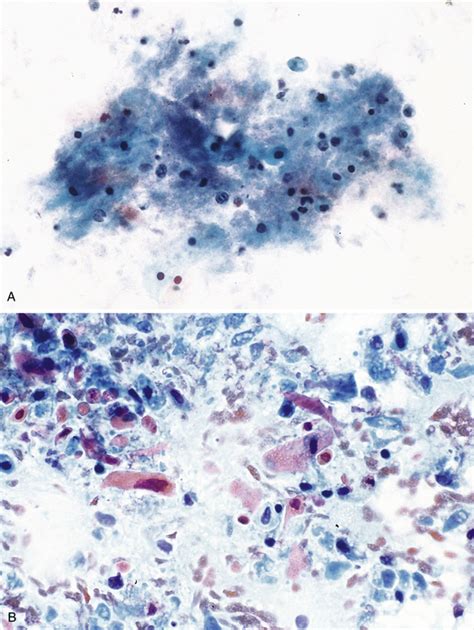 Salivary Gland Basicmedical Key