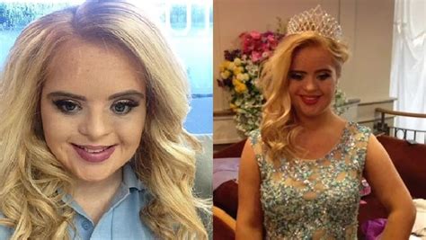 Teen Becomes First Person With Downs Syndrome To Win An International Beauty Pageant Social