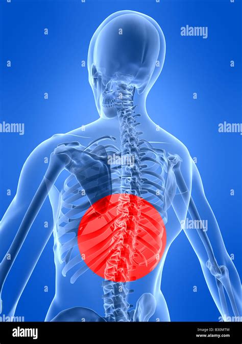 Back Inflammation Stock Photo Royalty Free Image 19070708 Alamy