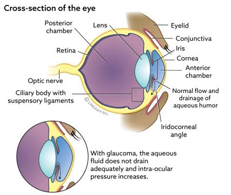 Burmese and siamese cats are among the predisposed breeds secondary glaucoma, which is far more common than primary glaucoma in cats, may develop in one or both eyes, but it is not predictably bilateral or. Glaucoma in Cats | VCA Animal Hospital