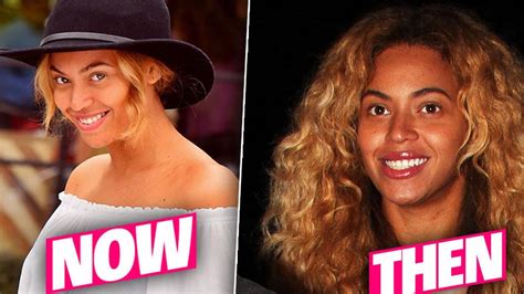 Pretty Hurts Beyonce Has Secret Nose Job Top Plastic Surgeons Reveal
