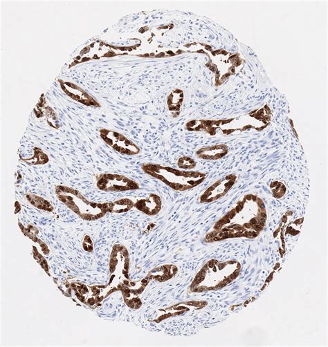 P16 Antibody Clone Jap16 Oncodianova P16 Anti Human For Ihc