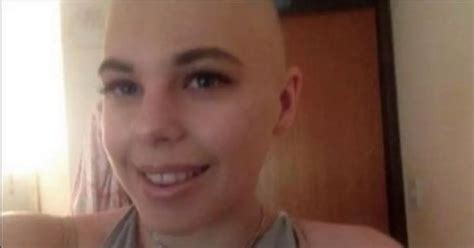 bullies make life hell for girl who went totally bald in two weeks devon live