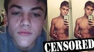 Dolan Twins Leaked Nudes The Best Porn Website