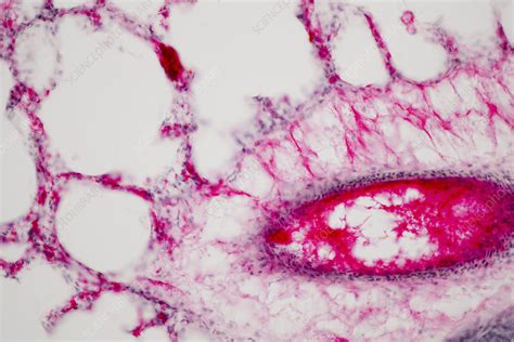 Human Lung Tissue Light Micrograph Stock Image F0323517 Science