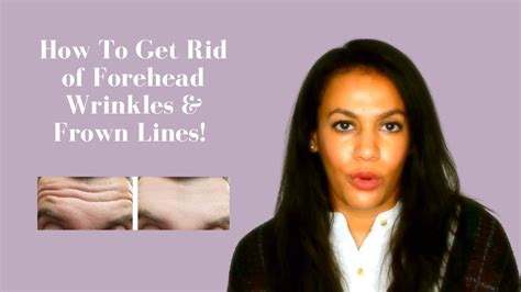 Forehead Wrinkles And Frown Lines Treatments With Botox Fillers Or Skincare Youtube