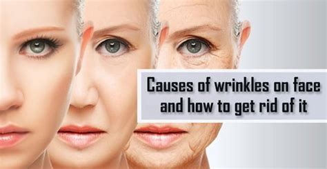 Causes Of Wrinkles On Face And How To Get Rid Of It