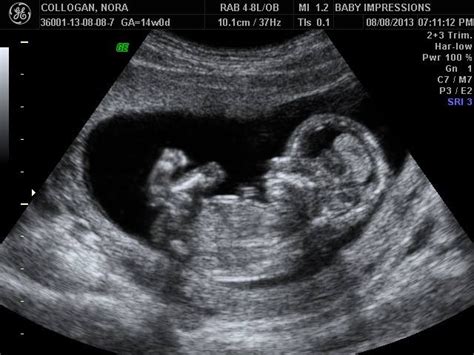 Of course i'll get ultrasounds! nora's little nook: September 2013