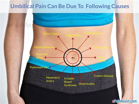 Causes Of Belly Button Pain Or Umbilical Pain Pain Referred Pain