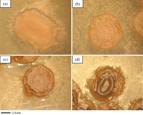 Emergence Of Aureobasidium Pullulans As Human Fungal Pathogen And