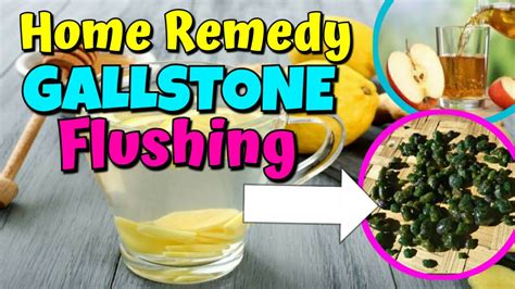 Home Remedies For Gallstone Treatmentgallstone Flushing Youtube