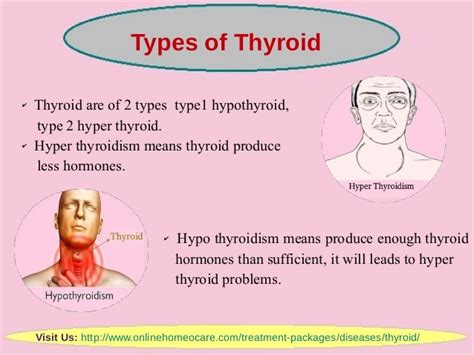 Online Thyroid Treatment Through Homeopathy