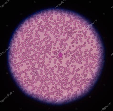 Red Blood Cell Picture Under A Microscope Red Blood Cells Under