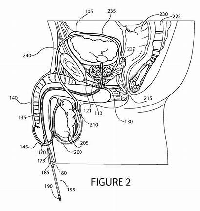 Patents Patent Catheter Bladder Foley Prostate Drawing