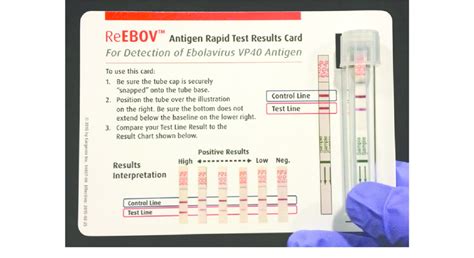 Information on local influenza activity. ReEBOVAntigen Rapid Test Kit results card. The results ...
