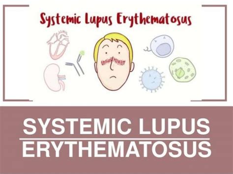 Magnesium Deficiency In Systematic Lupus Erythematosus Morgan Genus