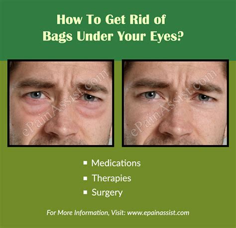 What Causes Bags Under Your Eyes And How To Get Rid Of It