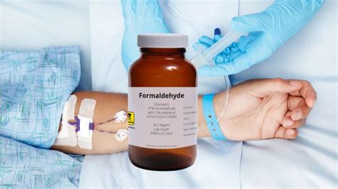 Woman Dies After Being Given Formaldehyde Instead Of Saline Drip During Routine Surgery The