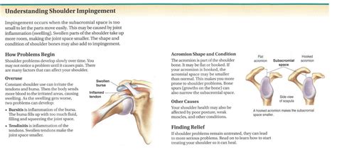 The bursa can become inflamed and swell with more fluid causing pain. Dr. John Skedros | Understanding-Shoulder-Impingement2