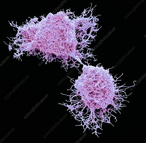 Mesenchymal Stem Cells Sem Stock Image C0230854 Science Photo