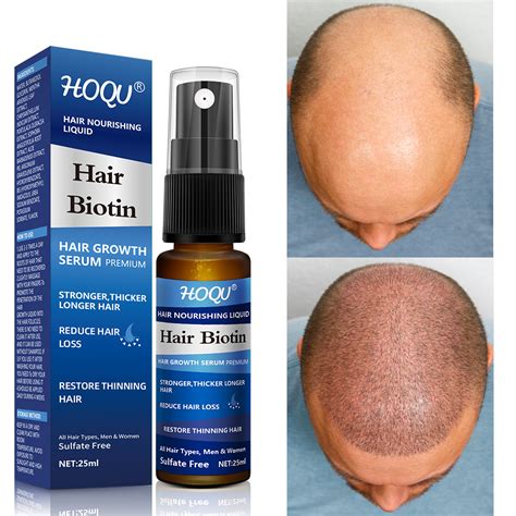 Hoqu Hair Growth Products Oils Treatment Fast Hair Care Spray Anti Loss Biotin