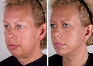 Lift jowls & turkey neck! 8 Great Facial Exercises That Help Lift Your Jowls | New ...