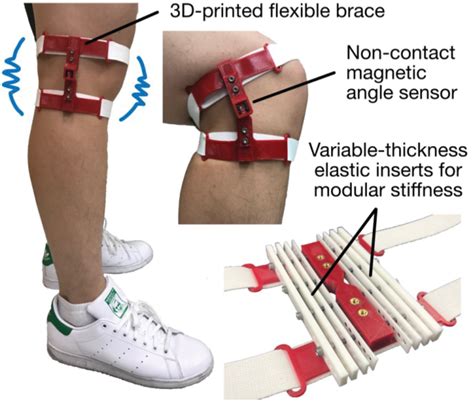 3d Printed Knee Brace To Aid Rehab Elderly Lower Extremity Review