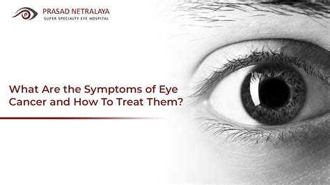 What Are The Symptoms Of Eye Cancer And How To Treat Them Vision