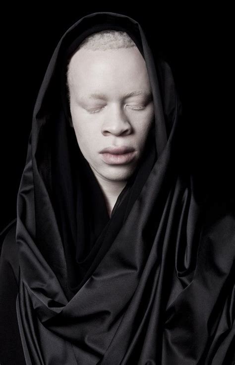 In Pictures Albinism And Perceptions Of Beauty Albino Model Black