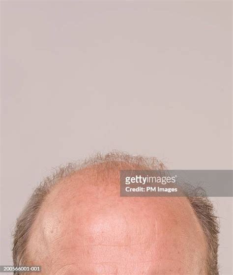 Top Of Head Photos And Premium High Res Pictures Getty Images
