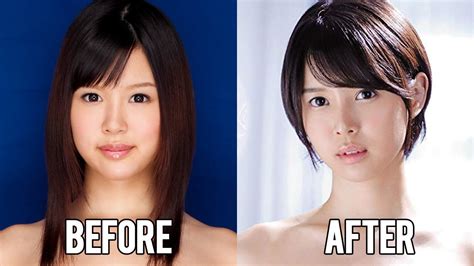 Japanese Plastic Surgery Before And After Hot Sex Picture