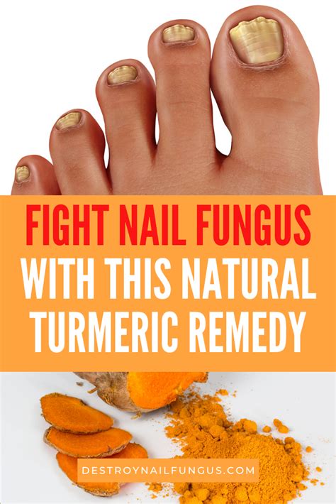Turmeric For Nail Fungus Will It Really Work For You
