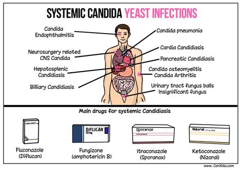 Systemic Candida Yeast Infections Candida Yeast Infection Yeast