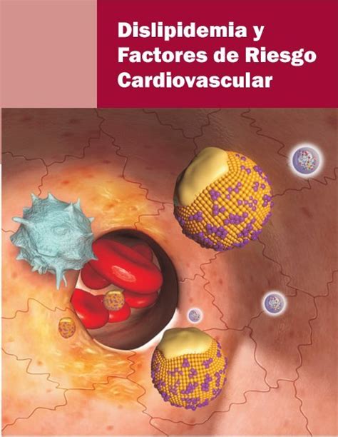 Dislipidemia Y Factores De Riesgo Lancet Mx Inicio